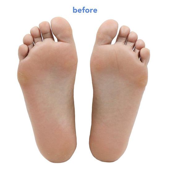 Fruit Acid Smoothing Foot Peel with plant-based alcohol – boscia